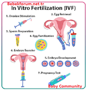 How Is IVF Treatment Done -123618261835127835178.png
