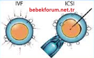 ICSI ve IVF Arasındaki Fark Nedir.jpg