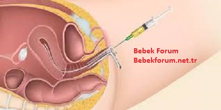 Kısırlık Tedavisinde Tüp Bebek Ne Zaman Yapılır - 1254364367834221.jpg